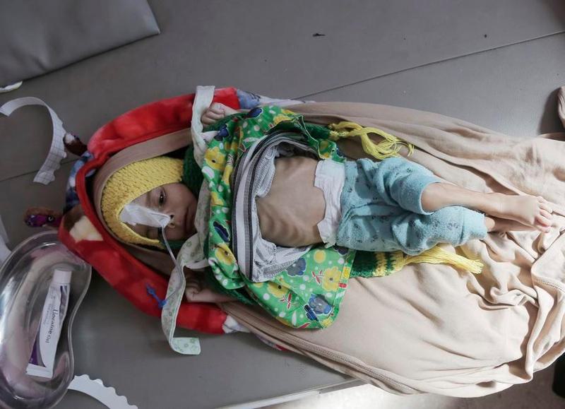 (Multimedia) Agencia de ONU suspenderá operaciones en áreas de Yemen controladas por hutíes y despedirá a 360 empleados, dicen fuentes